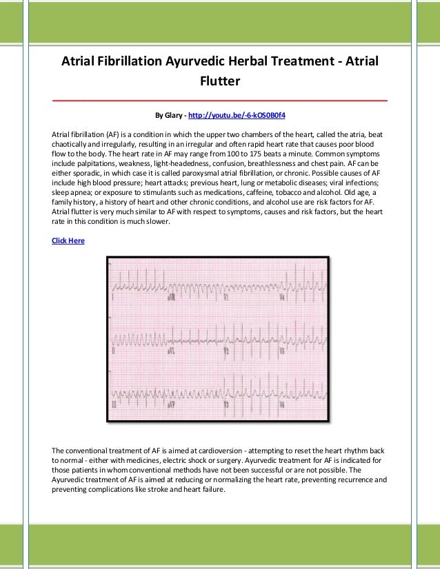 Atrial flutter