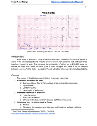 Faisal A. Al Moaiqel                                           http://www.slideshare.net/AlMoaiqel1

                                                                                                            1


                                               Atrial Flutter




                       (Atrial flutter is most easily seen in lead II , also aVR & aVF leads)


Introduction:
          Atrial  flutter  is  a  common  tachycardia  (fast  heart  beat)  that results from a rapid  electrical
circuit  in  the  atrium associate with irregular p­wave. It result from abnormal  path for the electrical
impulse  through  the  atria.  That  increase  the  contractility  of  atrium   up  to  250­350  beats  per
minute.  In  other  word,  when  the  atrial  pulse  is  over  250  bpm,  and  there  is  no  flat  baseline
between p­waves, “ atrial flutter ” is present. People with atrial flutter are more risky to get stroke.


Causes 1 :
       The causes of Atrial flutter may divide into three main categories.
    1. Conditions related to the heart :
          a. Decreased blood flow to the heart due to ischemia or atherosclerosis.
          b. Hypertension.
          c. Cardiomyopathy.
          d. hypertrophy of a chamber.
    2. Diseases elsewhere in  the body:
          a. Hyperthyroidism.
          b. Pulmonary embolism.
          c. Chronic obstructive pumonary disease COPD or emphysema.
    3. Substance may contribute to atrial flutter:
          a. Alcohol.
          b. Stimulants like: cocaine, amphetamines, cold medicine and even caffeine.
1
  "Atrial Flutter Causes ­ eMedicineHealth." 2006. 4 Feb. 2013
<http://www.emedicinehealth.com/atrial_flutter/page2_em.htm>
 