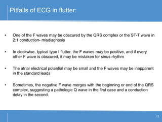 Pitfalls of ECG in flutter:
12
• One of the F waves may be obscured by the QRS complex or the ST-T wave in
2:1 conduction- misdiagnosis
• In clockwise, typical type I flutter, the F waves may be positive, and if every
other F wave is obscured, it may be mistaken for sinus rhythm
• The atrial electrical potential may be small and the F waves may be inapparent
in the standard leads
• Sometimes, the negative F wave merges with the beginning or end of the QRS
complex, suggesting a pathologic Q wave in the first case and a conduction
delay in the second.
 
