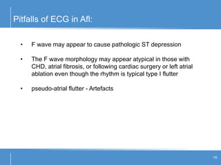 Pitfalls of ECG in Afl:
15
• F wave may appear to cause pathologic ST depression
• The F wave morphology may appear atypical in those with
CHD, atrial fibrosis, or following cardiac surgery or left atrial
ablation even though the rhythm is typical type I flutter
• pseudo-atrial flutter - Artefacts
 