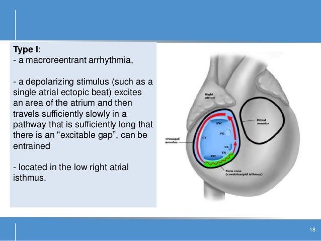flutter meaning medical flutter meaning medical
