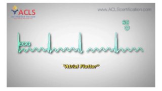 Atrial Flutter by ACLS Certification Institute 