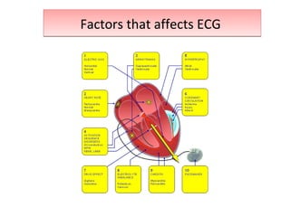 Factors that affects ECGFactors that affects ECG
 
