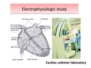 Electrophysiologic studyElectrophysiologic study
Cardiac catheter laboratory
 