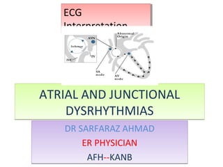ATRIAL AND JUNCTIONAL
DYSRHYTHMIAS
ATRIAL AND JUNCTIONAL
DYSRHYTHMIAS
DR SARFARAZ AHMAD
ER PHYSICIAN
AFH--KANB
DR SARFARAZ AHMAD
ER PHYSICIAN
AFH--KANB
ECG
Interpretation
ECG
Interpretation
 