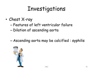 Investigations
• Chest X-ray
– Features of left ventricular failure
– Dilation of ascending aorta
– Ascending aorta may be calcified : syphilis
JMJ 15
 