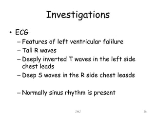 Investigations
• ECG
– Features of left ventricular falilure
– Tall R waves
– Deeply inverted T waves in the left side
chest leads
– Deep S waves in the R side chest leasds
– Normally sinus rhythm is present
JMJ 16
 