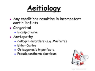 Aeitiology
 Any conditions resulting in incompetent
aortic leaflets
 Congenital
 Bicuspid valve
 Aortopathy
 Collagen disorders (e.g. Marfan’s)
 Ehler-Danlos
 Osteogenesis imperfecta
 Pseudoxanthoma elasticum
 