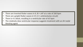 All you want to know about atrial rhythm.pptx