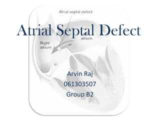 Atrial Septal Defect
Arvin Raj
061303507
Group B2
 