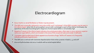 Electrocardiogram 
• Sinus rhythm or atrial fibrillation or flutter may be present. 
• The QRS axis is typically rightward in secundumASD, and “crochetage” of the QRS complex may be seen in 
the inferior leads. when the rSr prime pattern occurs with crochetage in each of the inferior limb leads, the 
specificity of the electrocardiographic diagnosis of atrial septal defect is remarkably high 
• Negative P waves in the inferior leads indicate a low atrial pacemaker, often seen in sinus venosus–superior 
vena cava–type defects, which are located in the area of the sinoatrial node and render it deficient. 
• Complete right bundle branch block appears as a function of age. Tall R or R′ waves in V1 frequently 
indicate pulmonary hypertension. 
• The QRS axis is vertical with clockwise depolarization that writes q waves in leads 2, 3, and aVF 
• sinus arrhythmia does not occur in adults with an atrial septal defect 
 