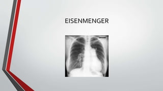 EISENMENGER 
 