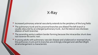 X-Ray 
• Increased pulmonary arterial vascularity extends to the periphery of the lung fields 
• The pulmonary trunk and its proximal branches are dilated The left branch is 
usually obscured by an enlarged pulmonary trunk , but the lateral view discloses 
dilation of both branches 
• The ascending aorta is seldom border forming because the intracardiac shunt does 
not traverse the aortic root . 
• In young adults with pulmonary vascular disease and a balanced or reversed shunt, 
the pulmonary trunk and its branches are strikingly enlarged and calcified (Right 
atrial enlargement is characteristic 
 