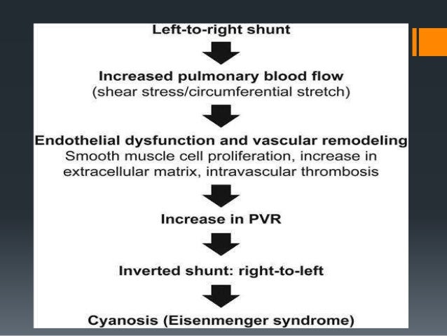 Pathophysiology Of Ventricular Septal Defect In Flow Chart