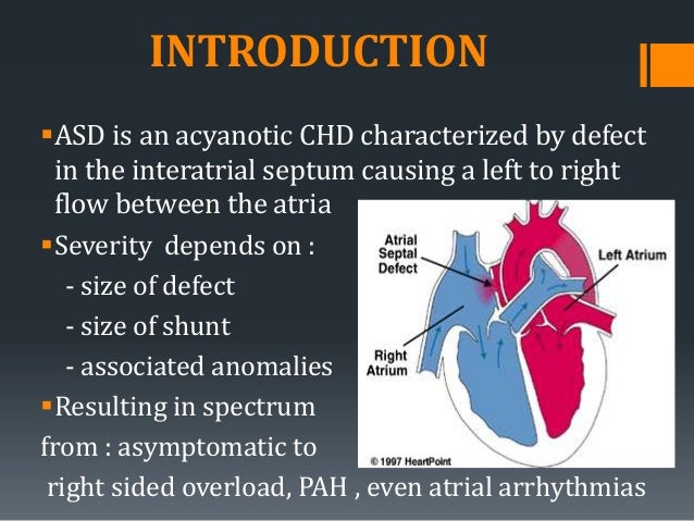 atrial septal defect ppt slideshare
