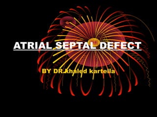 ATRIAL SEPTAL DEFECT
BY DR.khaled kartella
 