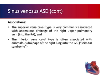 Atrial septal defect | PPTX