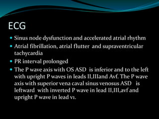Atrial septal defect | PPTX