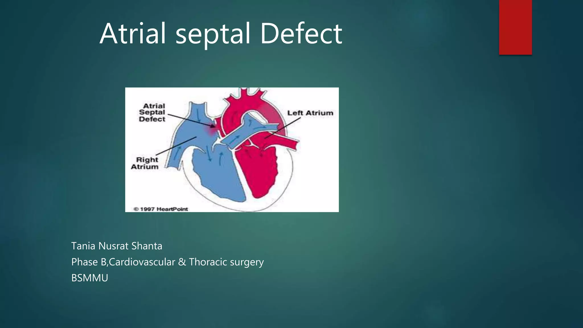 Atrial septal defect .by shanta | PPT