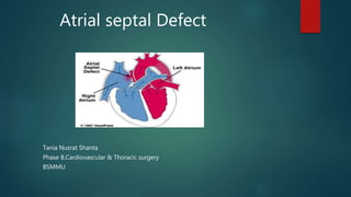 Atrial septal Defect
Tania Nusrat Shanta
Phase B,Cardiovascular & Thoracic surgery
BSMMU
 