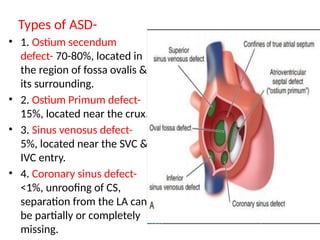 Atrial Septal Defect_Naznin_madam_all_pptx | PPTX