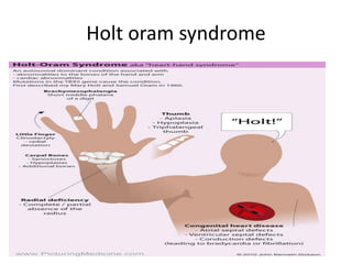 Holt oram syndrome
 