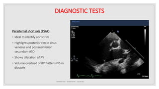 Atrial septal defect (ASD) | PPTX