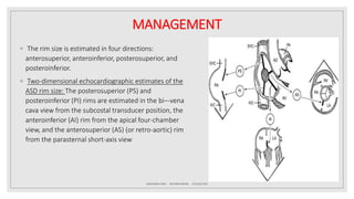 Atrial septal defect (ASD) | PPTX