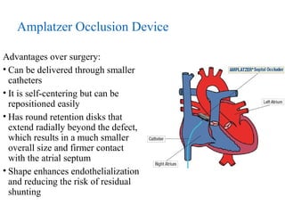 Atrial septal defects 16 3-15 | PPT