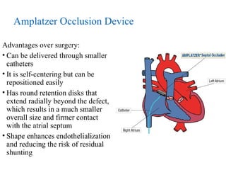 Amplatzer – deployment of right
atrial disc
 