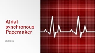Atrial
synchronous
Pacemaker
MUGESH G
 