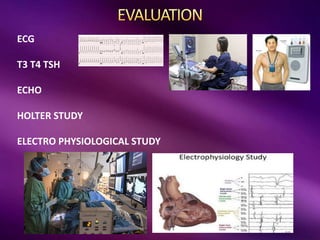 ECG
T3 T4 TSH
ECHO
HOLTER STUDY
ELECTRO PHYSIOLOGICAL STUDY
 