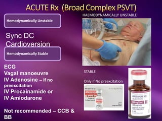 STABLE
Only if No preexcitation
HAEMODYNAMICALLY UNSTABLE
Hemodynamically Unstable
Sync DC
Cardioversion
Hemodynamically Stable
ECG
Vagal manoeuvre
IV Adenosine – if no
preexcitation
IV Procainamide or
IV Amiodarone
Not recommended – CCB &
BB
 