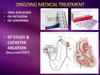 • ORAL B BLOCKER
• OR DILTIAZEM
• OR VERAPAMIL
• EP STUDY &
CATHETER
ABLATION
(Recurrent PSVT)
 