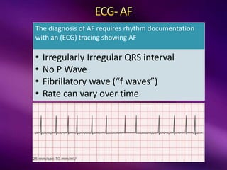 The diagnosis of AF requires rhythm documentation
with an (ECG) tracing showing AF
• Irregularly Irregular QRS interval
• No P Wave
• Fibrillatory wave (“f waves”)
• Rate can vary over time
 