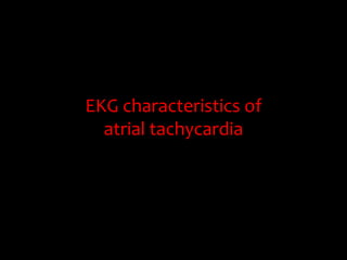 EKG characteristics of 
  atrial tachycardia
 