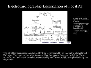 Electrocardiographic Localization of Focal AT

                                                                                             (Zipes DP, Jalife J.
                                                                                             Cardiac
                                                                                             Electrophysiology:
                                                                                             From cell to
                                                                                             bedside, 4th
                                                                                             edition. 2004; pg.
                                                                                             503)



                                            Superolateral Inferolateral   Annulus   Septal




Focal atrial tachycardia is characterized by P waves separated by an isoelectric interval in all
ECG leads. There are various algorithms available that look at P-wave morphology. These
are useful, but the P-wave can often be obscured by the T wave or QRS complexes during the
tachycardia.
 
