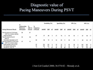 Diagnostic value of
Pacing Maneuvers During PSVT




      J Am Col Cardiol 2000; 36:574-82 – Morady et al.
 