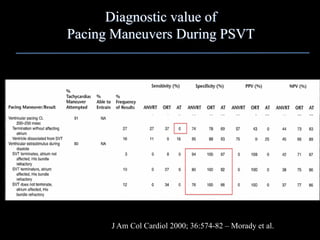 Diagnostic value of
Pacing Maneuvers During PSVT




      J Am Col Cardiol 2000; 36:574-82 – Morady et al.
 