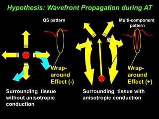 Hypothesis: Wavefront Propagation during AT
             QS pattern                   Multi-component
                                               pattern




                Wrap-                        Wrap-
                around                       around
                Effect (-)                   Effect (+)
Surrounding tissue           Surrounding tissue with
without anisotropic          anisotropic conduction
conduction
 