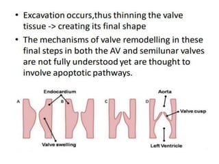 Atrioventricular canal defect | PPTX