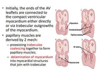 Atrioventricular canal defect | PPTX