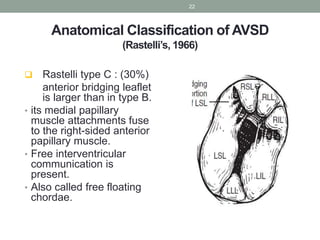 Atrioventricular septal defects | PPTX