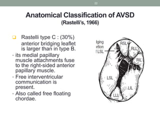 Atrioventricular septal defects