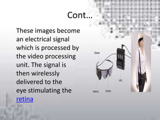 Cont…
These images become
an electrical signal
which is processed by
the video processing
unit. The signal is
then wirelessly
delivered to the
eye stimulating the
retina
 