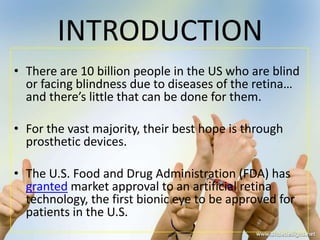 • There are 10 billion people in the US who are blind
or facing blindness due to diseases of the retina…
and there’s little that can be done for them.
• For the vast majority, their best hope is through
prosthetic devices.
• The U.S. Food and Drug Administration (FDA) has
granted market approval to an artificial retina
technology, the first bionic eye to be approved for
patients in the U.S.
INTRODUCTION
 