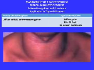 MANAGEMENT OF A PATIENT PROCESS
CLINICAL DIAGNOSTIC PROCESS
Pattern Recognition and Prevalence
Application in Thyroid Disorders
Primary Clinical Diagnosis Signs and Symptoms
Diffuse colloid adenomatous goiter Diffuse goiter
PR < 90 / min
No signs of malignancy
 
