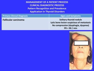 MANAGEMENT OF A PATIENT PROCESS
CLINICAL DIAGNOSTIC PROCESS
Pattern Recognition and Prevalence
Application in Thyroid Disorders
Primary Clinical Diagnosis Signs and Symptoms
Follicular carcinoma Solitary thyroid nodule
Lytic bone lesion suspicious of metastasis
No compression (dysphagia, dyspnea)
PR < 90 / min
 