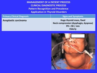 MANAGEMENT OF A PATIENT PROCESS
CLINICAL DIAGNOSTIC PROCESS
Pattern Recognition and Prevalence
Application in Thyroid Disorders
Primary Clinical Diagnosis Signs and Symptoms
Anaplastic carcinoma Huge thyroid mass, fixed
Neck compression (dysphagia, dyspnea)
PR < 90 / min
Elderly
 