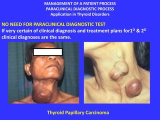 MANAGEMENT OF A PATIENT PROCESS
PARACLINICAL DIAGNOSTIC PROCESS
Application in Thyroid Disorders
NO NEED FOR PARACLINICAL DIAGNOSTIC TEST
If very certain of clinical diagnosis and treatment plans for1O & 2O
clinical diagnoses are the same.
Thyroid Papillary Carcinoma
 